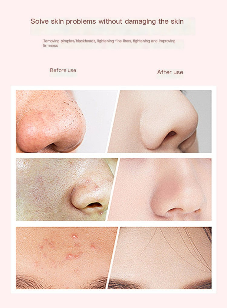 Escova Facial Elétrica - Limpeza profunda da pele