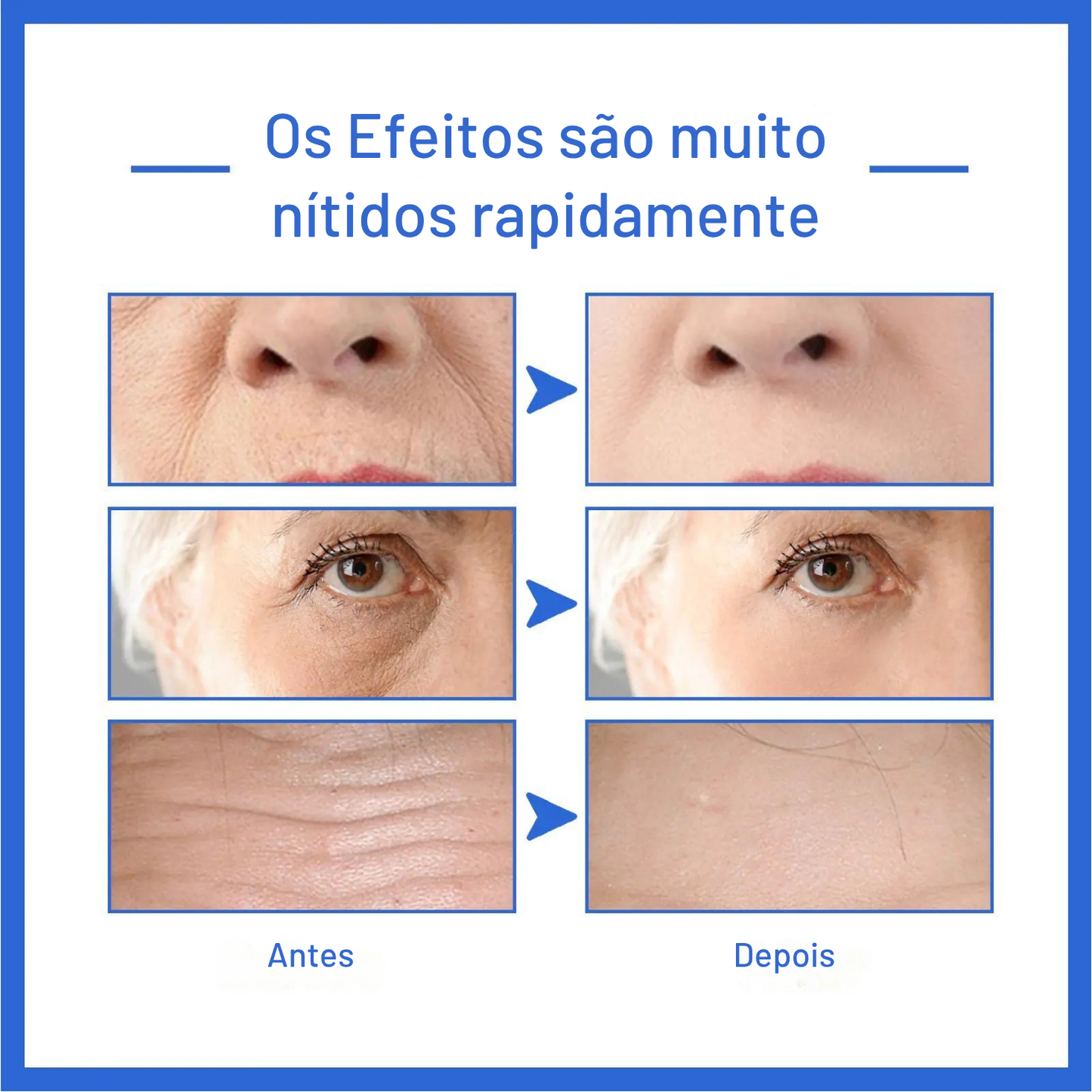 Sérum Potencializador Lumyé – Firmeza & Brilho Instantâneos 30ml