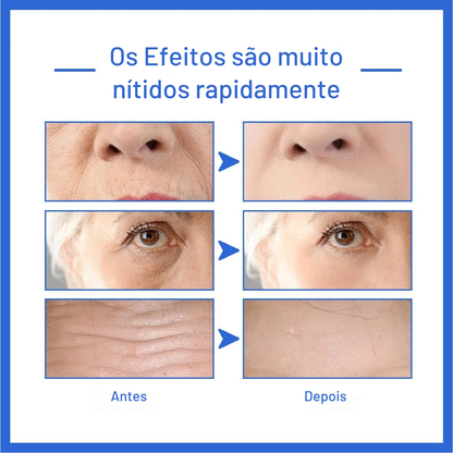 Sérum Potencializador Lumyé – Firmeza & Brilho Instantâneos 30ml